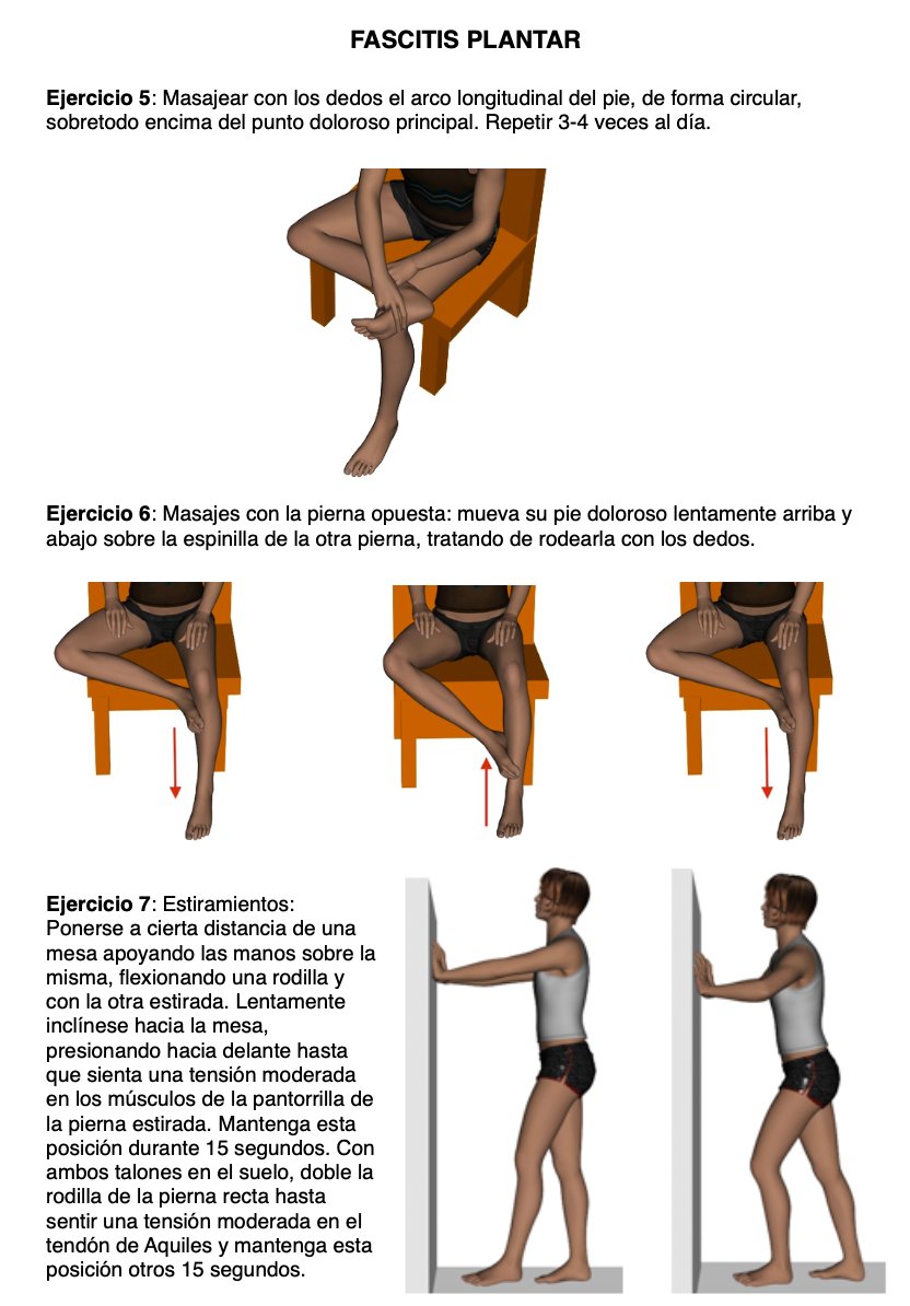 Ejercicios de fascitis plantar